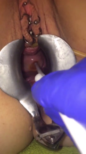 Cervix Extreme Gyno Play